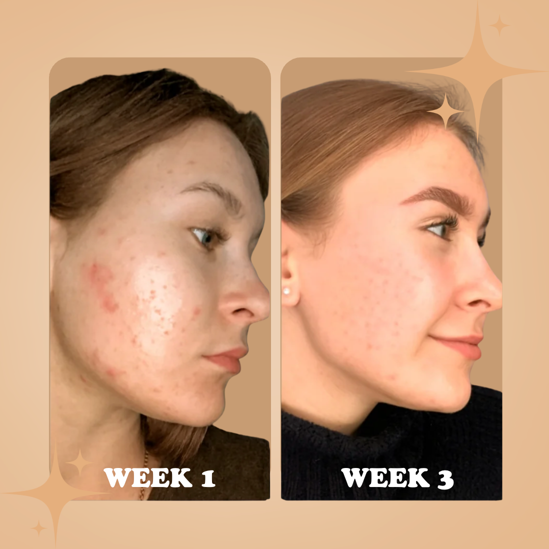 Blemish B'Gone Roll