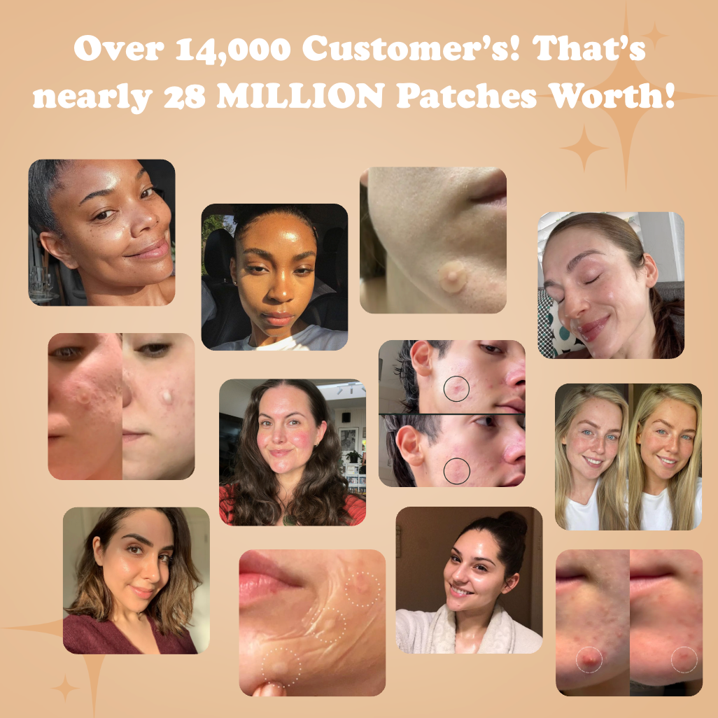 Blemish B'Gone Roll